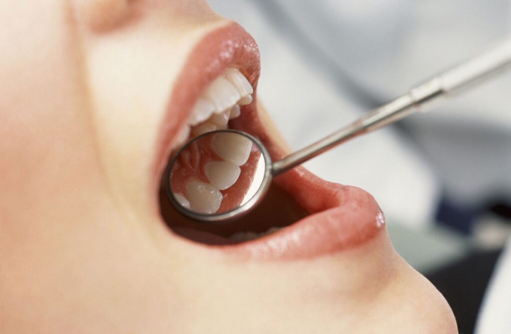 How to prevent common dental problems
